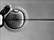 sperm injection into oocyte